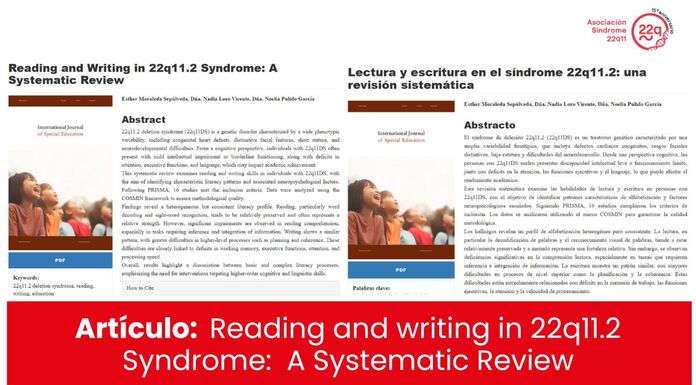 Nueva publicacin cientfica sobre el Sndrome 22q11